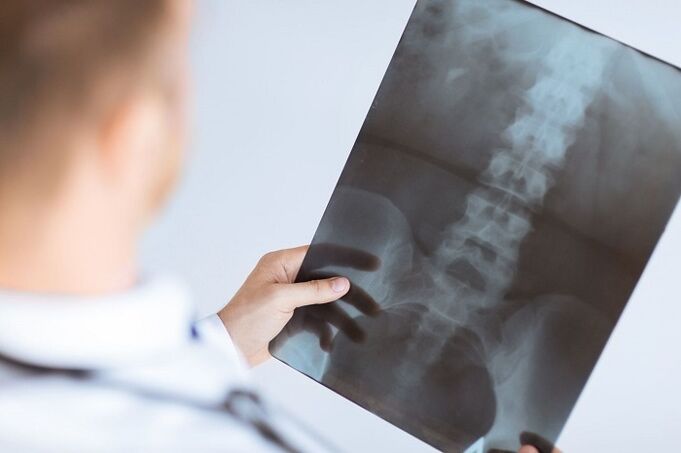 Opcións de diagnóstico para a osteocondrose lumbar