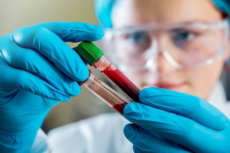 Exame de sangue completo para diagnosticar dor lumbar